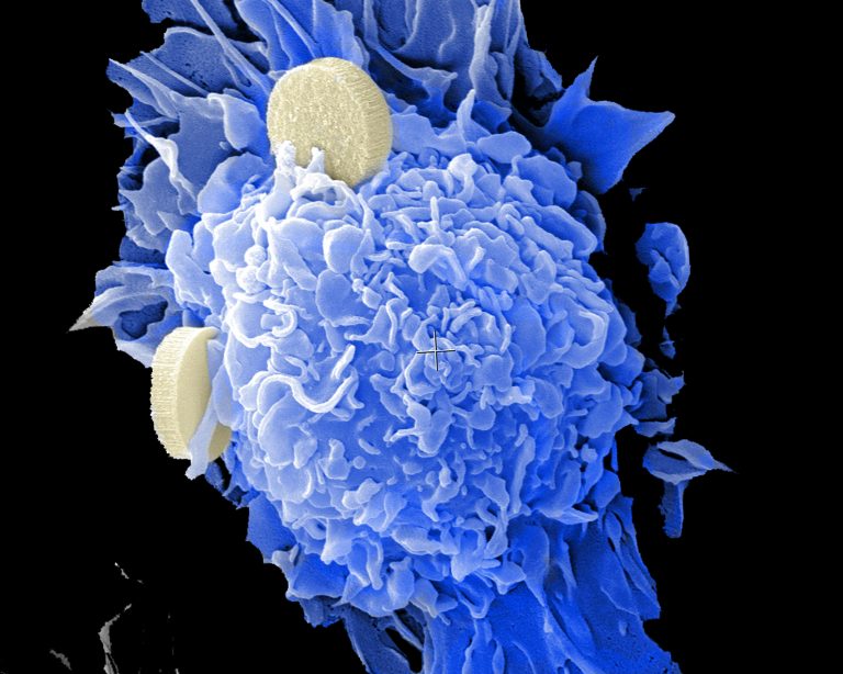 Quantum Computing for Photon-Drug Interactions in Cancer Prevention and Treatment